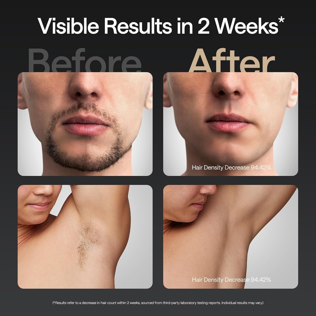 Ulike Air 10 IPL Hair Removal Device w/out Leather Case, For Men, Black 