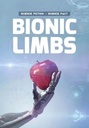 Science Fiction/Science Fact: Bionic Limbs